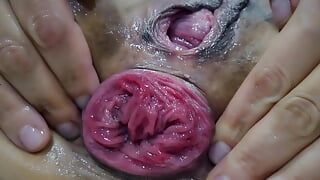 fisting anal prolapse purchase plan 3